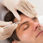 Botox Treatment for Men