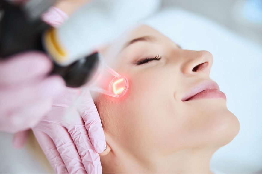 Pico laser treatment