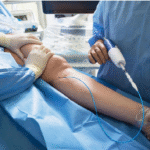 Endovascular Device Supplier